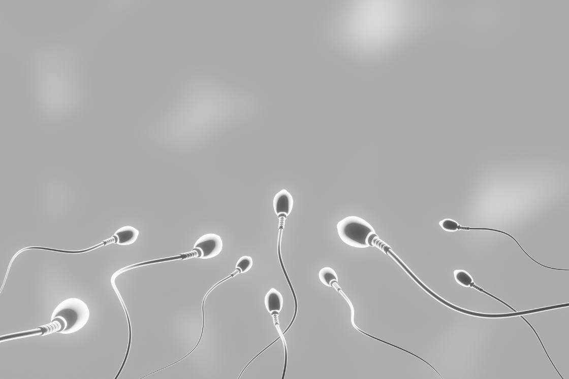 Azoospermia causas diagnóstico
